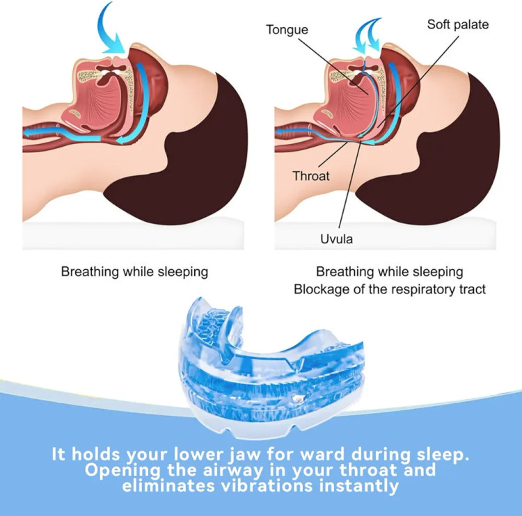 درمان خروپف در خانه